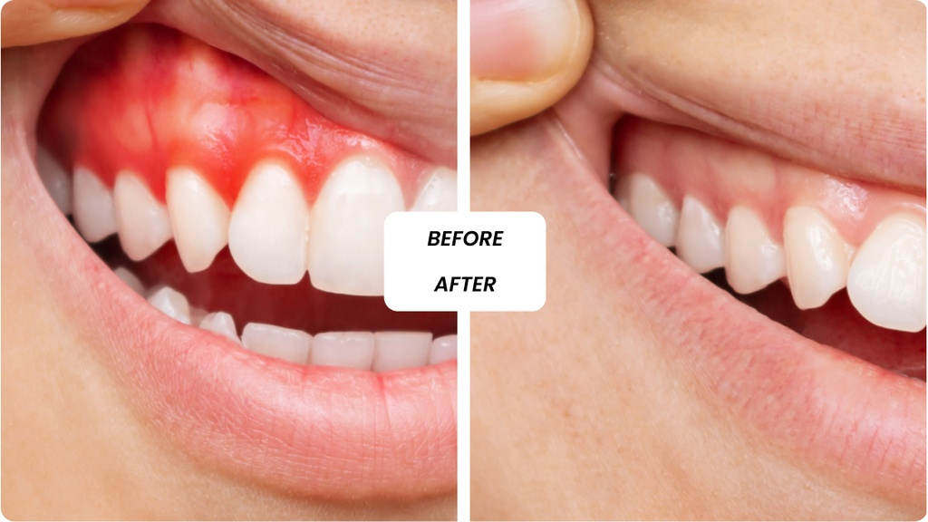 Cosmetic Dentistry in Dubai: Transforming Smiles with Modern Dental Techniques