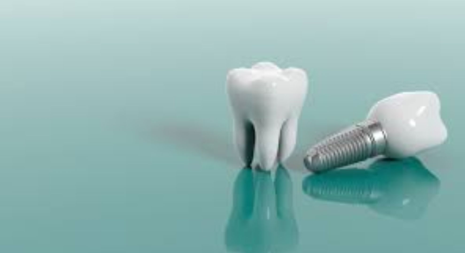 What To Consider Before Choosing Best Dental Implants?