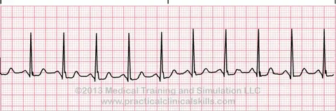 Comprehensive Cardiac Diagnostics in Dubai: ECG and EKG Services