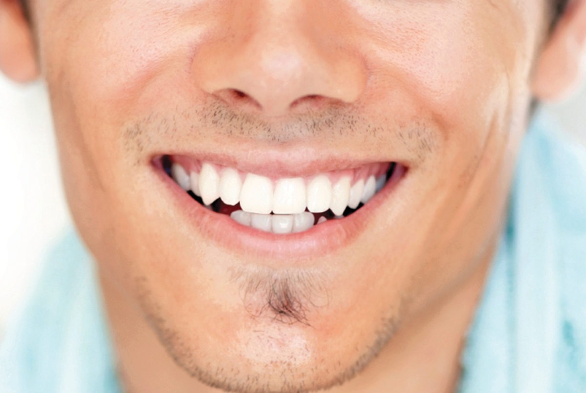 dental implants london prices